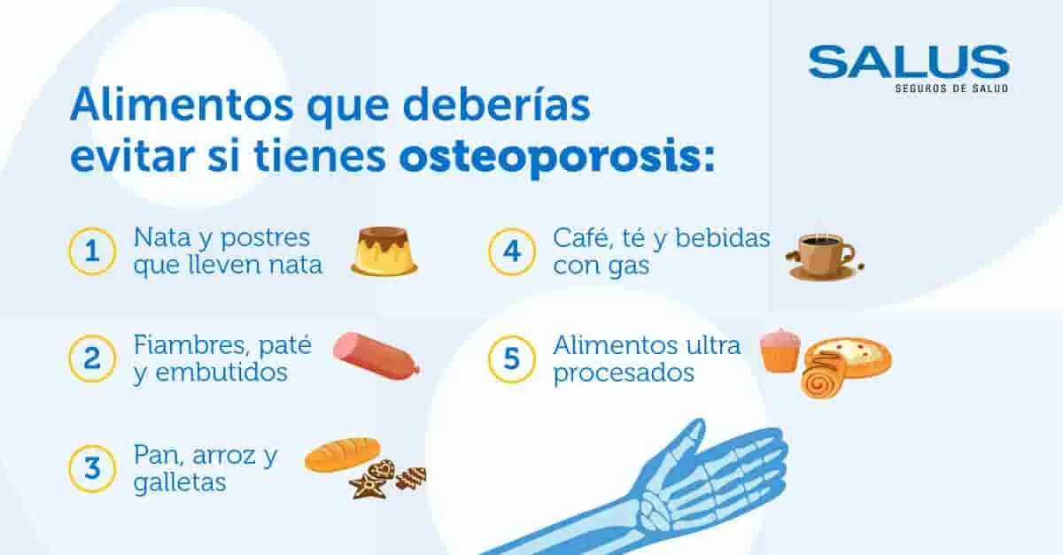 La relación entre la dieta y la prevención de la osteoporosis: alimentos ricos en calcio y vitamina D.